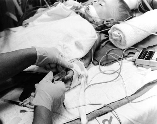 IV